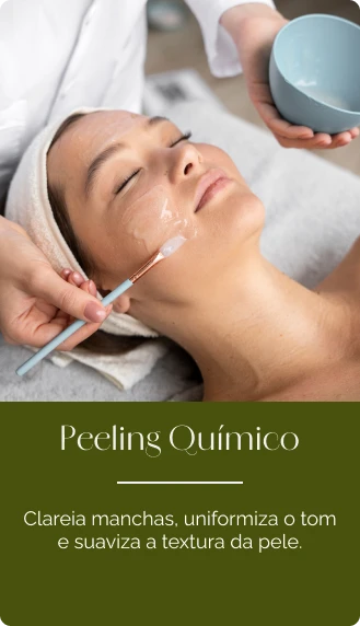 Aplicação de peeling químico