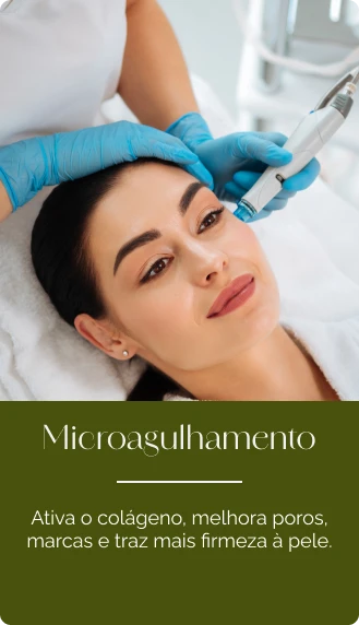 Sessão de microagulhamento facial